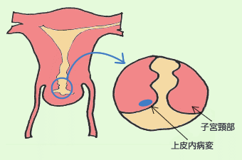 図：0期