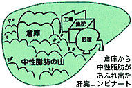 図：倉庫から中性脂肪があふれ出た肝臓コンビナート