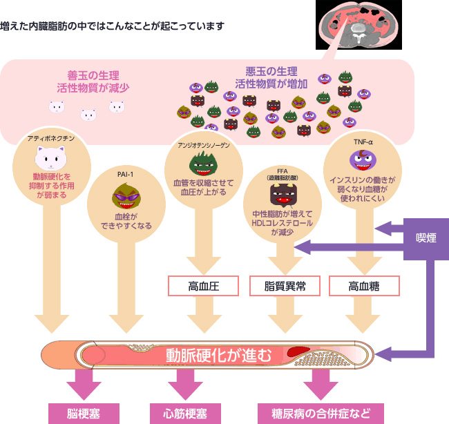 図：増えた内臓脂肪の中で起こっていること